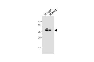 All lanes : Anti-LR6 Antibody (Center) at 1:1000 dilution Lane 1: Mouse heart tissue lysate Lane 2: Rat heart tissue lysate Lysates/proteins at 20 μg per lane. (LPAR6 Antikörper  (AA 106-134))