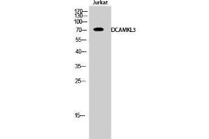 Western Blot (WB) analysis of Jurkat cells using DCAMKL3 Polyclonal Antibody. (DCLK3 Antikörper  (Internal Region))