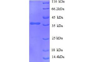 SDS-PAGE (SDS) image for Oxidoreductase YdhF (AA 1-298), (full length) protein (His tag) (ABIN5710670) (Oxidoreductase YdhF (AA 1-298), (full length) protein (His tag))
