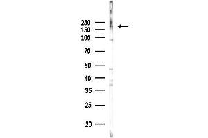 anti-Chromodomain Helicase DNA Binding Protein 2 (CHD2) (C-Term) antibody