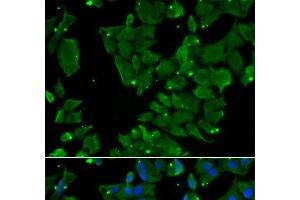 Immunofluorescence analysis of HeLa cells using DBN1 Polyclonal Antibody (DBN1 Antikörper)