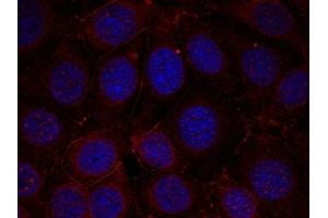 Immunofluorescence staining of methanol-fixed MCF cells using IGF-1R(Phospho-Tyr1165/Tyr1166) Antibody. (IGF1R Antikörper  (pTyr1165, pTyr1166))