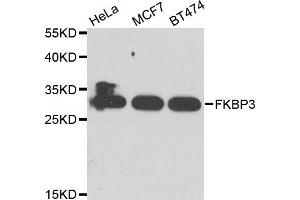 Western blot analysis of extracts of various cell lines, using FKBP3 antibody. (FKBP3 Antikörper)