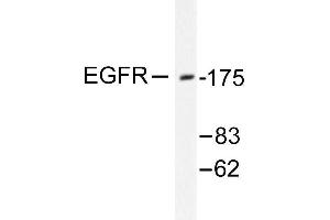 Image no. 1 for anti-Epidermal Growth Factor Receptor (EGFR) antibody (ABIN265395) (EGFR Antikörper)