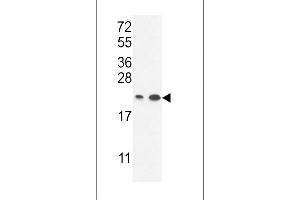 Western blot analysis in A2058,T47D cell line lysates (35ug/lane). (ABHD14B Antikörper  (C-Term))