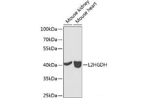 Western blot analysis of extracts of various cell lines using L2HGDH Polyclonal Antibody at dilution of 1:1000. (L2HGDH Antikörper)
