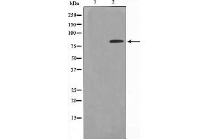 Western blot analysis on HeLa cell lysate using ZNF225 Antibody,The lane on the left is treated with the antigen-specific peptide. (ZNF225 Antikörper  (C-Term))