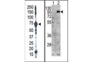 Image no. 1 for anti-Phosphatidylinositol-4-Phosphate 5-Kinase, Type I, gamma (PIP5K1C) (C-Term) antibody (ABIN360481) (PIP5K1C Antikörper  (C-Term))