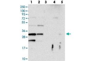 Western blot analysis of Lane 1: RT-4, Lane 2: U-251 MG, Lane 3: Human Plasma, Lane 4: Liver, Lane 5: Tonsil with FAM125A polyclonal antibody  at 1:100-1:250 dilution.