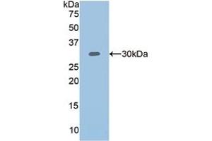 Detection of Recombinant PLS3, Human using Polyclonal Antibody to Plastin 3 (PLS3) (Plastin 3 Antikörper  (AA 379-630))