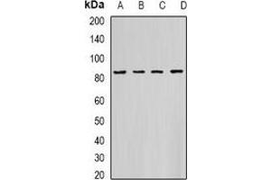 Western blot analysis of HADHA expression in K562 (A), PC3 (B), Hela (C), mouse heart (D) whole cell lysates. (HADHA Antikörper)