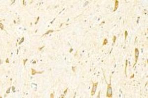 Immunohistochemistry analysis of paraffin-embedded mouse spinal cord using ADAMTS4 (ABIN7072947) at dilution of 1: 3000