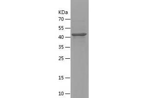 Western Blotting (WB) image for Diacylglycerol Kinase, alpha 80kDa (DGKA) (AA 341-555) protein (His-IF2DI Tag) (ABIN7122651) (DGKA Protein (AA 341-555) (His-IF2DI Tag))