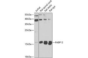 Western blot analysis of extracts of various cell lines, using F antibody  at 1:1000 dilution. (FABP12 Antikörper  (AA 1-140))