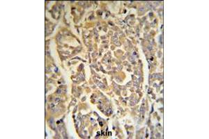 DCD Antibody (RB18706) IHC analysis in formalin fixed and paraffin embedded human skin tissue followed by peroxidase conjugation of the secondary antibody and DAB staining. (Dermcidin Antikörper  (C-Term))