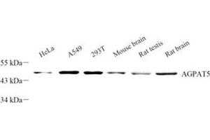 Western blot analysis of AGPAT5 (ABIN7072838) at dilution of 1: 300 (AGPAT5 Antikörper)