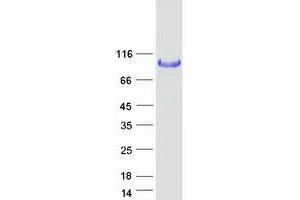 Western Blotting (WB) image for Hexokinase 1 (HK1) (Transcript Variant 1) protein (Myc-DYKDDDDK Tag) (ABIN2722677)
