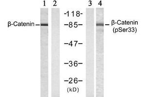 Western blot analysis of extracts from SW 626 cells , untreated or treated with Calyculin A (50nM, 30min), using β-Catenin (Ab-33) antibody (E021211, Lane 1 and 2) and β-Catenin (phospho-Ser33) antibody (E011218, Lane 3 and 4). (beta Catenin Antikörper  (pSer33))