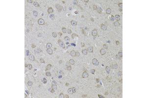 Immunohistochemistry of paraffin-embedded mouse brain using CD59 antibody. (CD59 Antikörper)