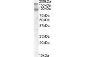 Western Blotting (WB) image for anti-CUB Domain Containing Protein 1 (CDCP1) (C-Term) antibody (ABIN2465191) (CDCP1 Antikörper  (C-Term))