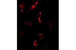 Immunofluorescent analysis of Nop30 staining in U2OS cells. (NOL3 Antikörper)
