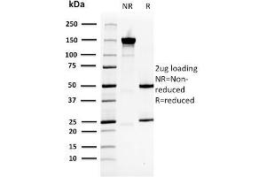 SDS-PAGE Analysis Purified HSP27 Mouse Monoclonal Antibody (CPTC-HSPB1-2). (HSP27 Antikörper)