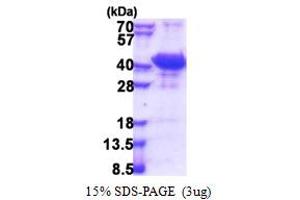 SDS-PAGE (SDS) image for Cerebral Cavernous Malformation 2 (CCM2) (AA 66-353) protein (His tag) (ABIN5853462) (CCM2 Protein (AA 66-353) (His tag))