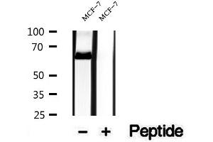 Western blot analysis of extracts of MCF-7 cells, using NR1D1 antibody.
