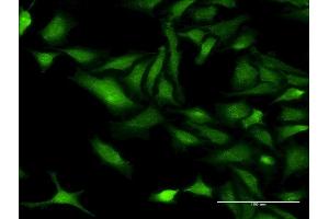 Immunofluorescence (IF) image for anti-Cholinergic Receptor, Nicotinic, beta 3 (Neuronal) (CHRNB3) (AA 128-223) antibody (ABIN514410)