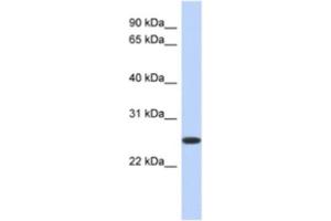Western Blotting (WB) image for anti-Flavin Reductase (BLVRB) antibody (ABIN2463954)