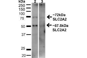 Western blot analysis of Human HeLa and HEK293T cell lysates showing detection of ~57. (SLC2A2 Antikörper  (C-Term) (PE))