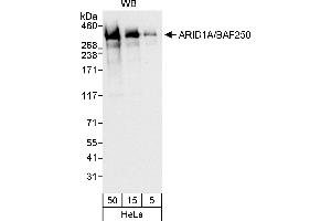 anti-AT Rich Interactive Domain 1A (SWI-Like) (ARID1A) (AA 750-800) antibody