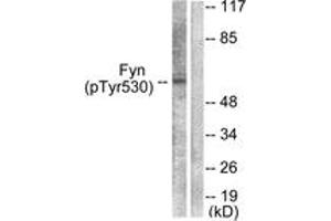 Western blot analysis of extracts from 293 cells treated with H2O2 100uM 15', using Fyn (Phospho-Tyr530) Antibody. (FYN Antikörper  (pTyr531))