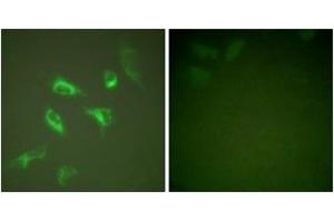 Immunofluorescence analysis of HeLa cells, using 14-3-3 zeta (Ab-58) Antibody. (14-3-3 zeta Antikörper  (AA 24-73))