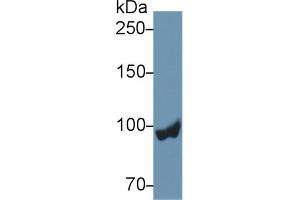 Western blot analysis of Rat Liver lysate, using Rat PYGL Antibody (2 µg/ml) and HRP-conjugated Goat Anti-Rabbit antibody ( (PYGL Antikörper  (AA 73-267))