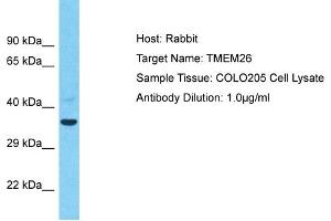 Host: Rabbit Target Name: TMEM26 Sample Type: COLO205 Whole Cell lysates Antibody Dilution: 1. (TMEM26 Antikörper  (C-Term))