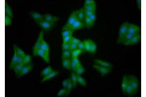 Immunofluorescence staining of HepG2 cells with ABIN7159657 at 1:100, counter-stained with DAPI. (MMADHC Antikörper  (AA 26-142))