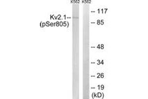 Western blot analysis of extracts from K562 cells treated with TNF 200ng/ml 30', using Kv2. (Kv2.1/KCNB1 Antikörper  (pSer805))