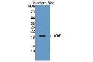 Western Blotting (WB) image for anti-WNT1 Inducible Signaling Pathway Protein 1 (WISP1) (AA 216-347) antibody (ABIN1176562) (WISP1 Antikörper  (AA 216-347))