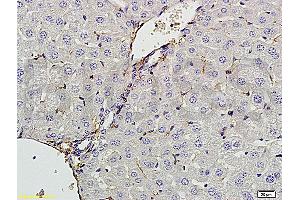 Formalin-fixed and paraffin embedded rat liver tissue labeled with Anti-CXCL13 Polyclonal Antibody, Unconjugated (ABIN706691) at 1:200 followed by conjugation to the secondary antibody and DAB staining