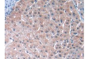 DAB staining on IHC-P; Samples: Human Liver Tissue (TUBE1 Antikörper  (AA 236-473))