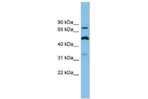 SLC26A1 antibody used at 1 ug/ml to detect target protein. (SLC26A1 Antikörper)