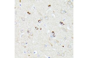 Immunohistochemistry of paraffin-embedded rat brain using CCDC6 antibody (ABIN7266442) at dilution of 1:100 (40x lens). (CCDC6 Antikörper  (AA 55-222))