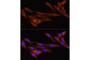 Immunofluorescence analysis of NIH/3T3 cells using  Rabbit pAb (ABIN7269965) at dilution of 1:100. (ARHGAP30 Antikörper  (AA 485-585))