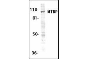 Western blot analysis of MTBP expression in K562 whole cell lysates with this product at 1 μg /ml. (MTBP Antikörper  (Middle Region))