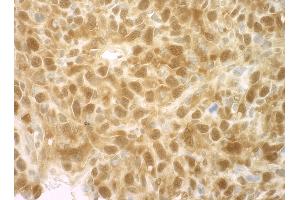Immunohistochemistry (IHC) image for anti-Eukaryotic Translation Initiation Factor 4E Binding Protein 1 (EIF4EBP1) (C-Term) antibody (ABIN7448395)