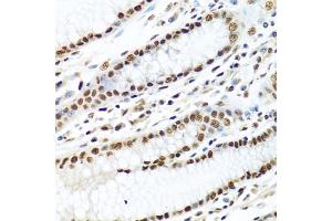 Immunohistochemistry of paraffin-embedded human stomach using METTL3 antibody. (METTL3 Antikörper)