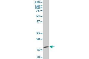 SURB7 monoclonal antibody (M03), clone 6B6 Western Blot analysis of SURB7 expression in HeLa . (MED21 Antikörper  (AA 1-144))