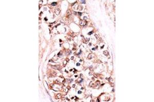 Image no. 1 for anti-Dual Specificity Phosphatase 14 (DUSP14) (N-Term) antibody (ABIN360794)