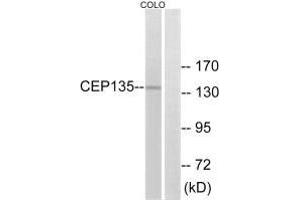 Western blot analysis of extracts from COLO cells, using CEP135 antibody. (CEP135 Antikörper  (C-Term))